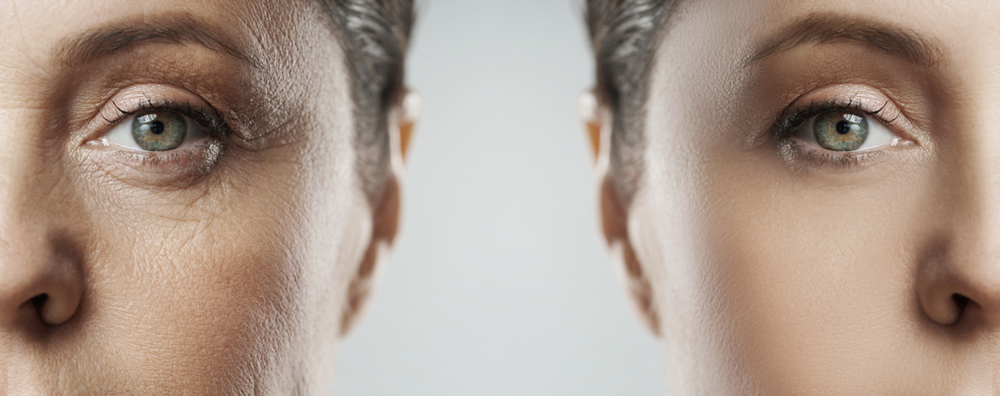 Combatting Lip Wrinkles for a Youthful Appearance