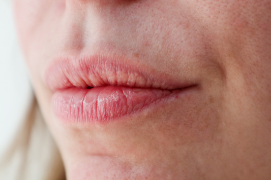 Conquering Vertical Lip Wrinkles: A Comprehensive Guide